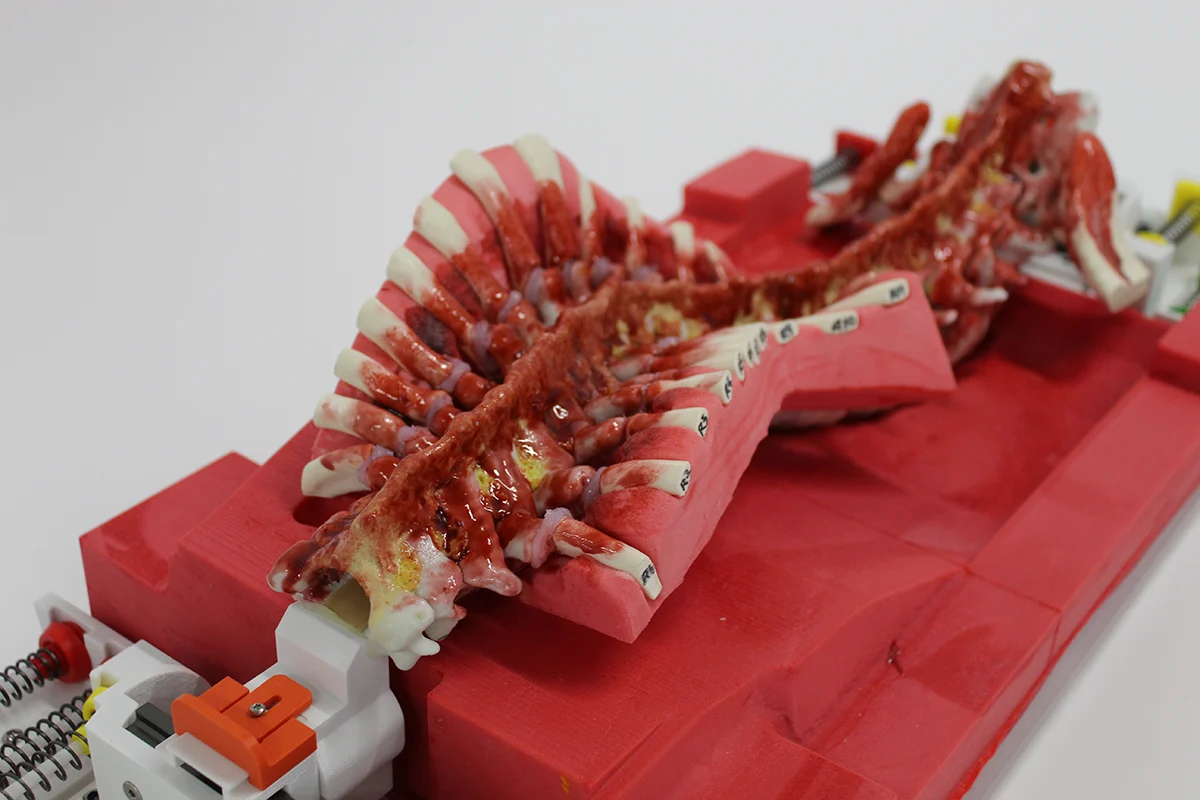Deformity correction with rods and screws on the RealSpine Deformity