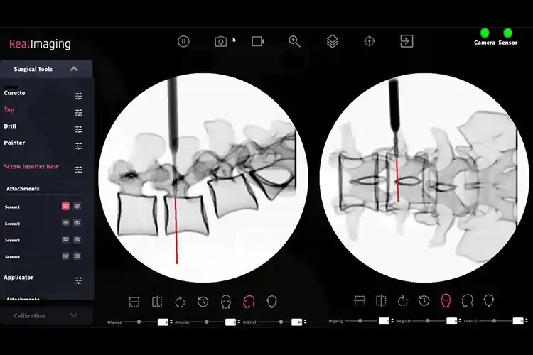 RealImaging on an iPad